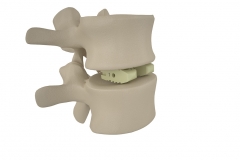Orthopedic-implant-render